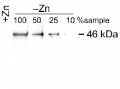 ZCP1 | Zinc Chaperone Protein